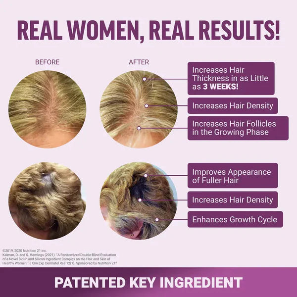 FemmiGlow Hair Growth Accelerator Gummies